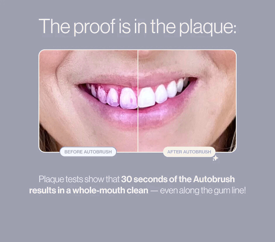 LumiBright™ 360° U-Shaped Toothbrush